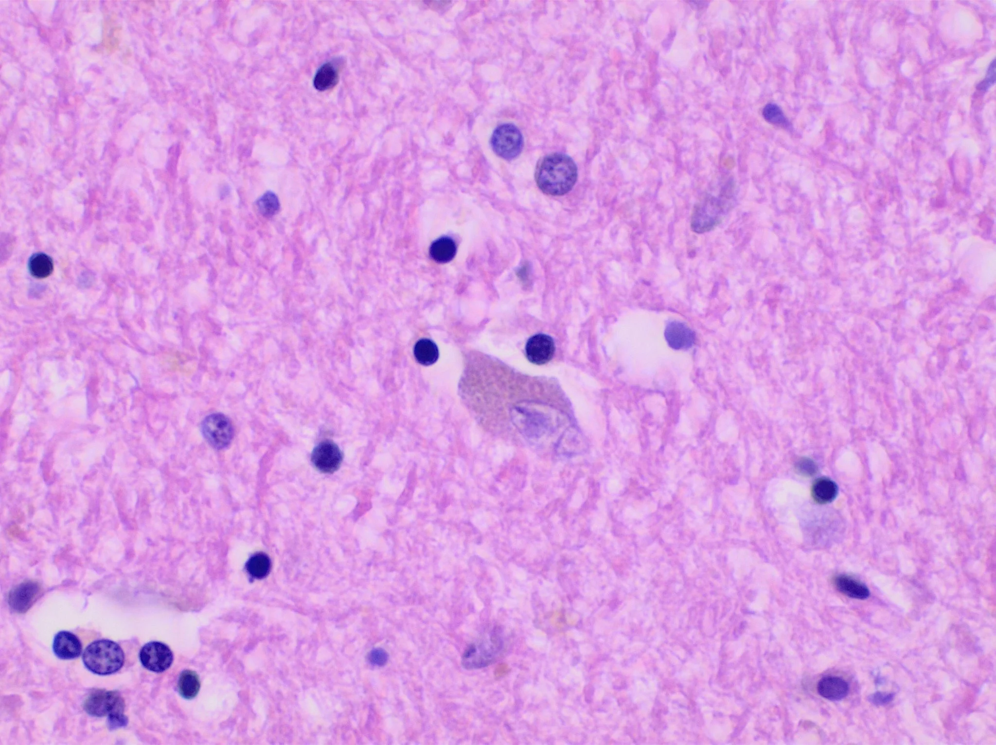 일반·특수 염색법 · Histology of thalamic neuron.