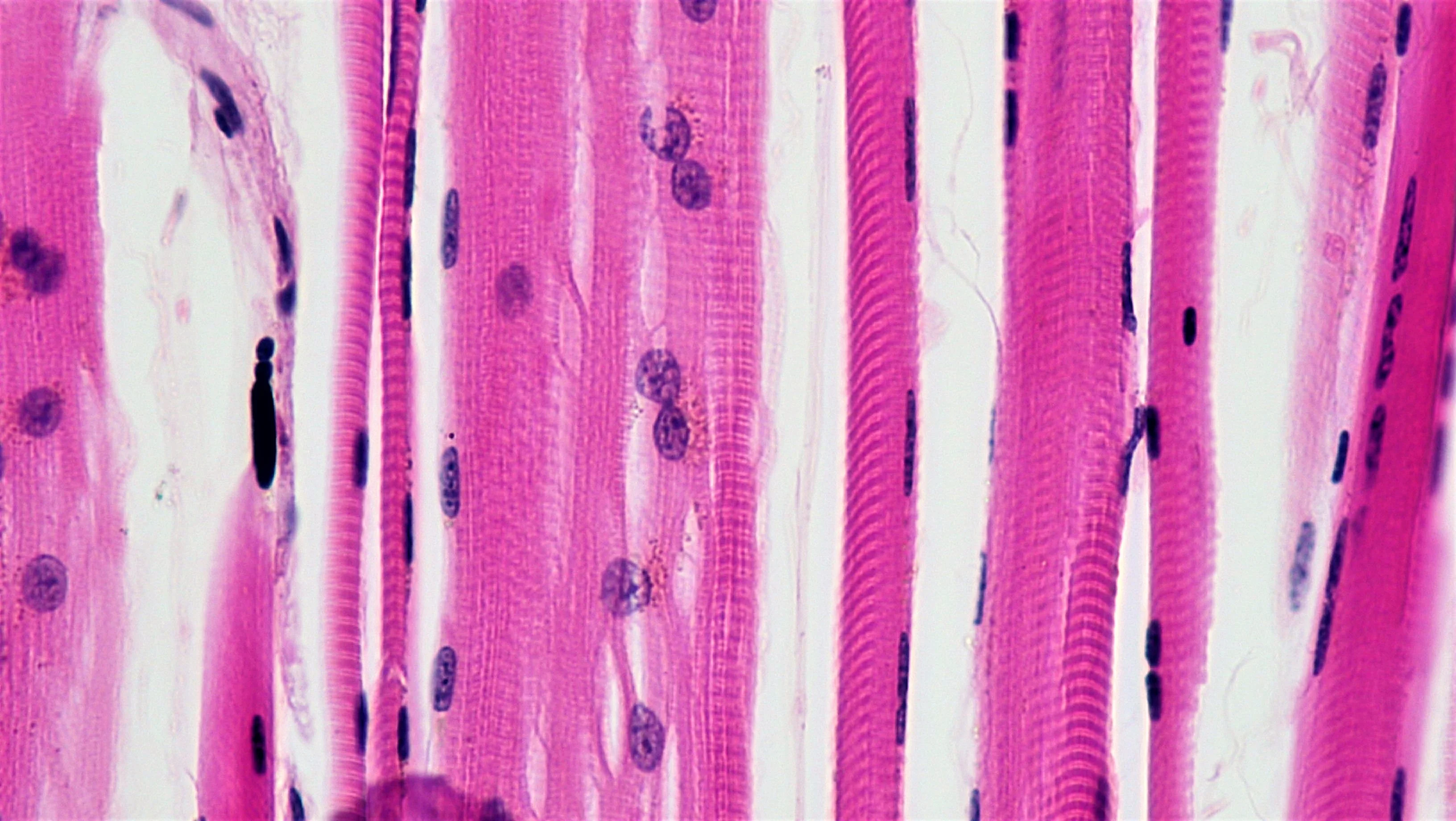 조직학 · Cross section: teased skeletal muscle magnification: 200x