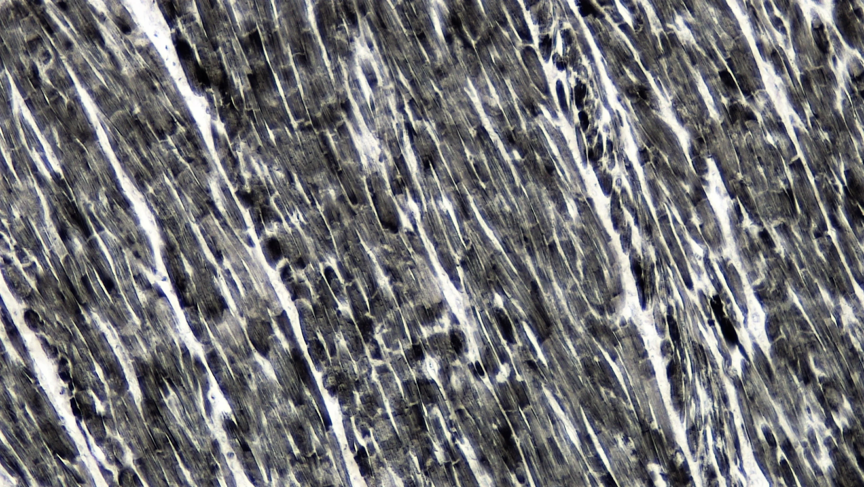조직학 · long section: cardiac muscle magnification: 100x
