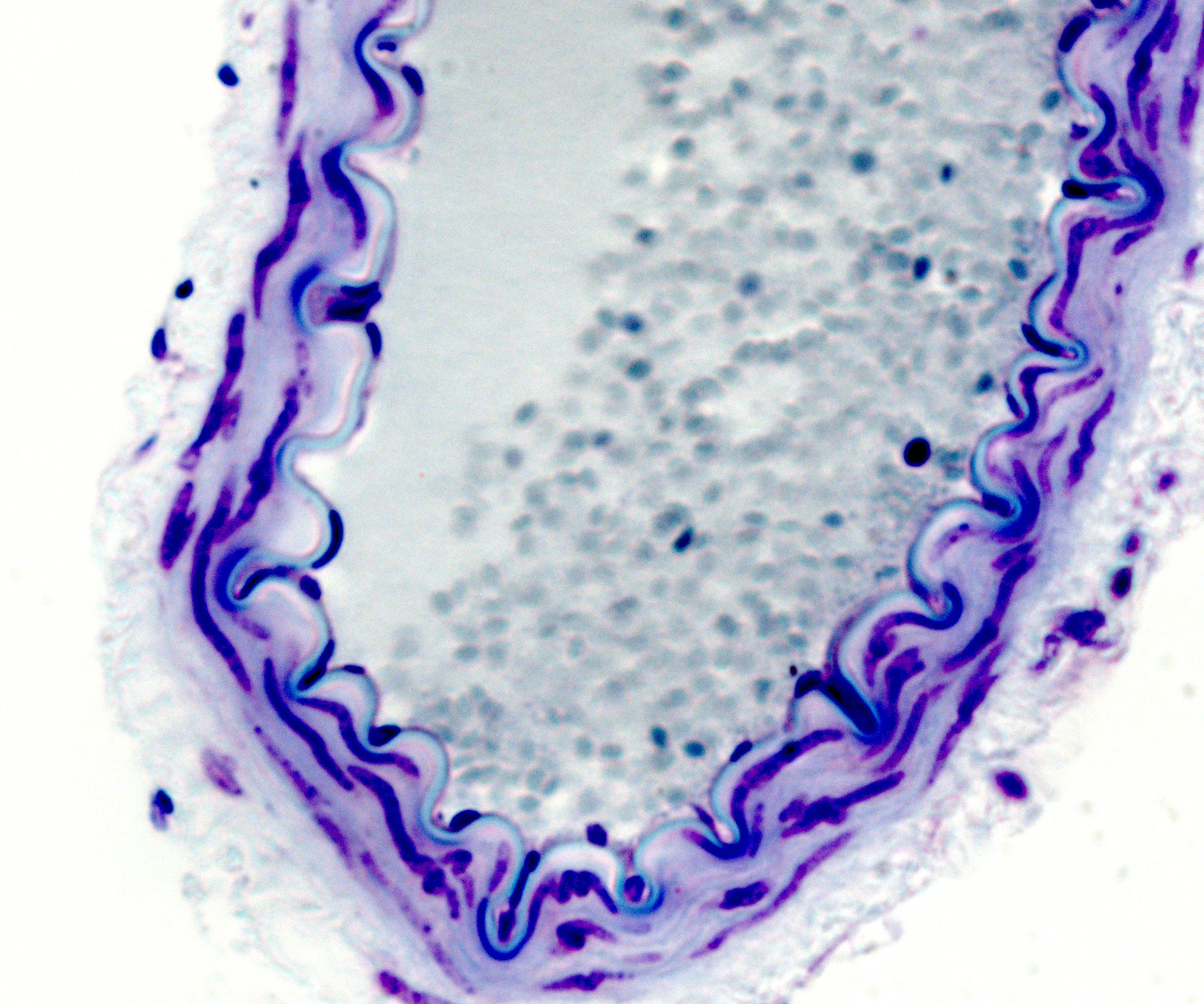 조직학 · Arteriole elastic membrane under microscope