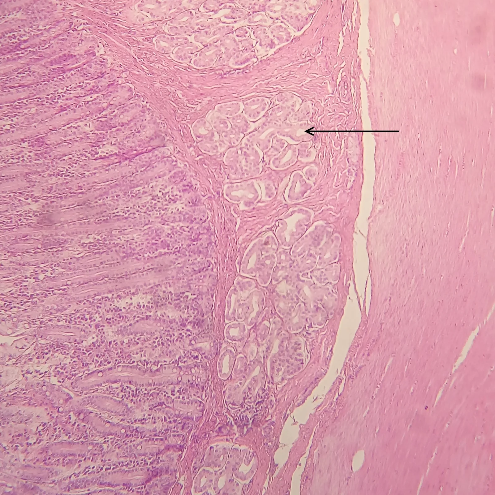 조직학 · Arrow: duodenal glands (or Brünner's glands).