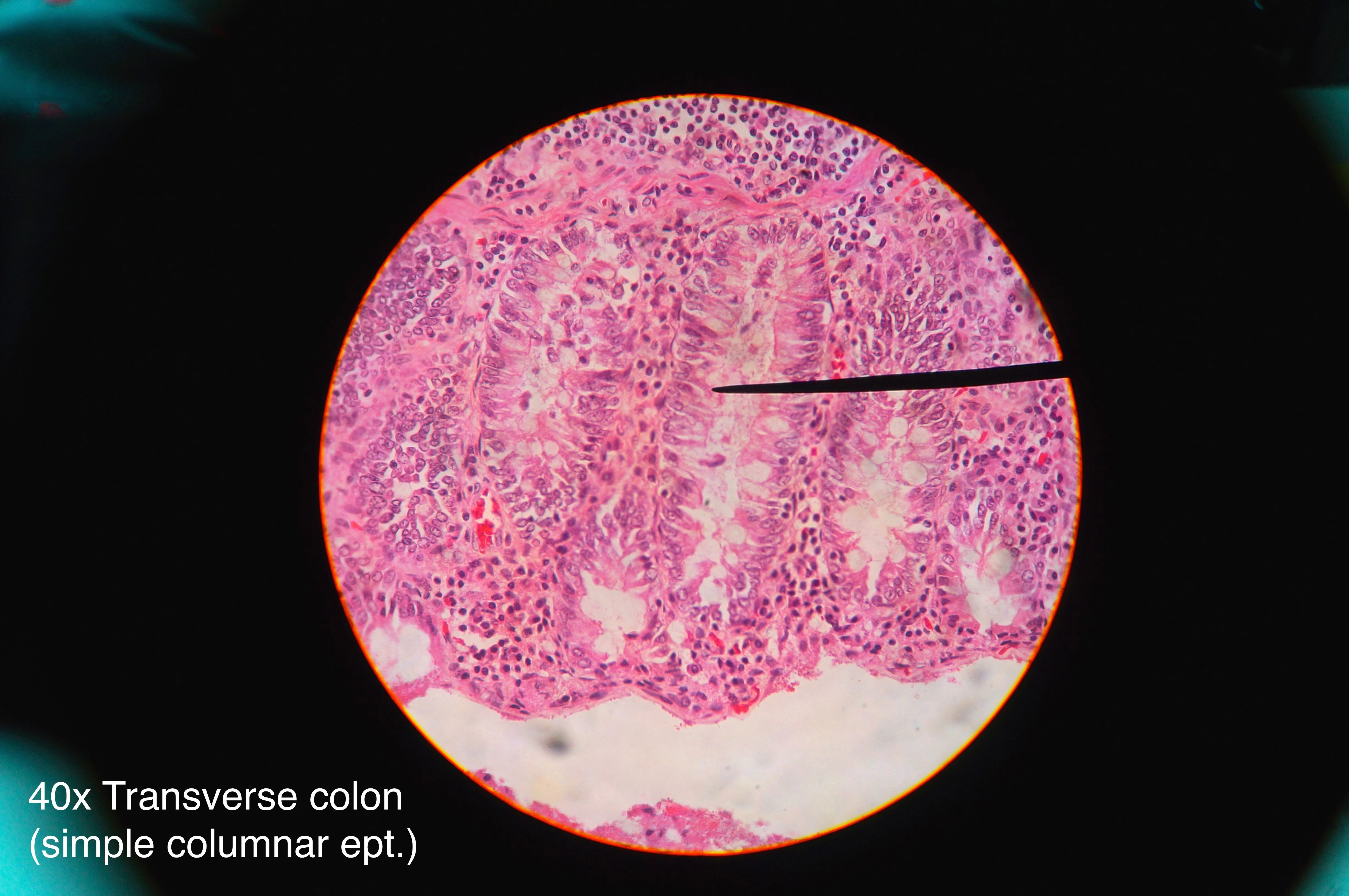 조직학 · Histology of transverse colon