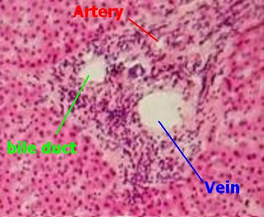 조직학 · Portal triad(artery,vein,bile duct)of Liver tissue.