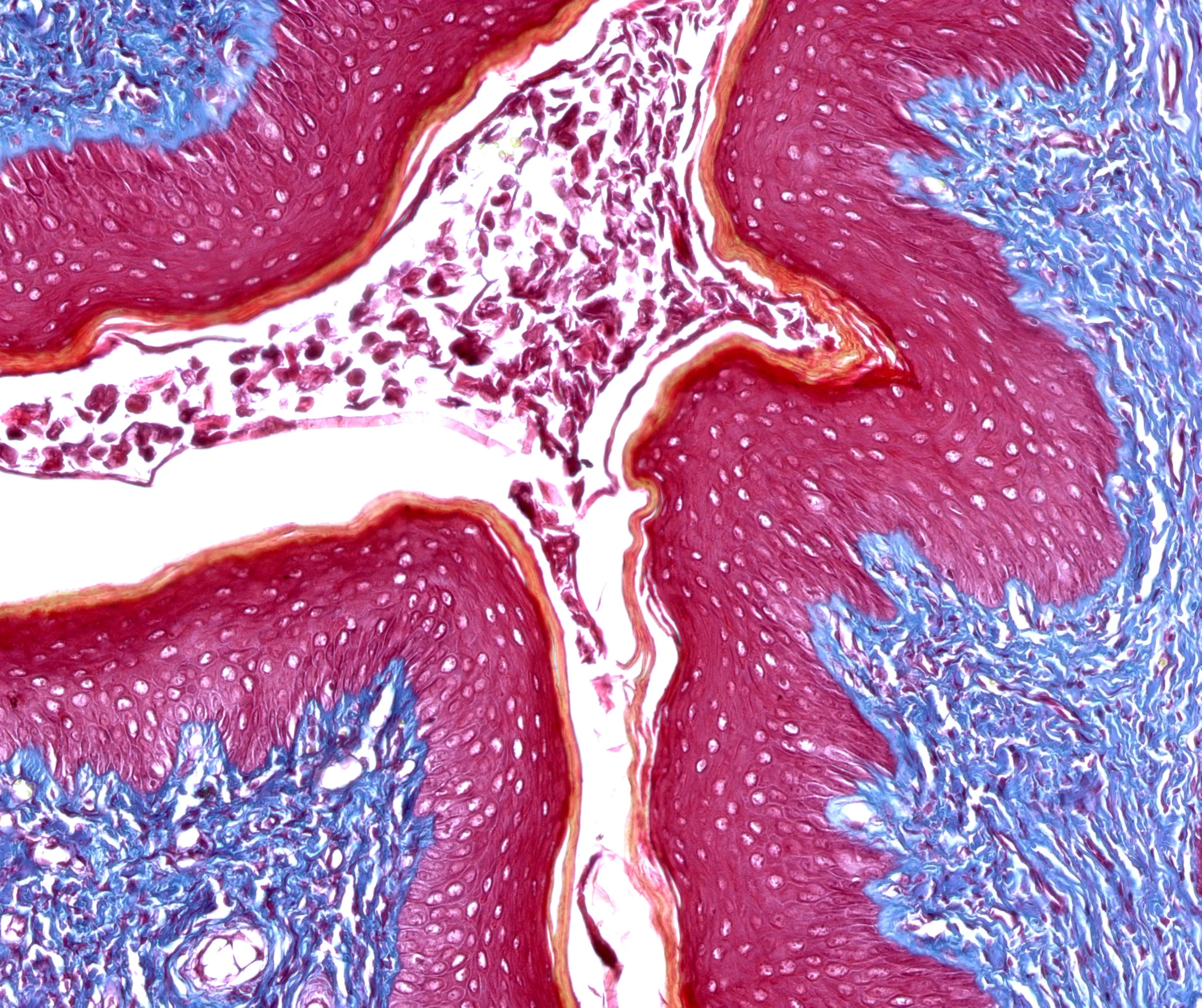 조직검사학 · The micrograph shows the vagina of a rat at the stage of estrus, i.e., ovulation. This is characterised by the keratinisation (yellow-orange) of the multilayered squamous non-keratinised epith