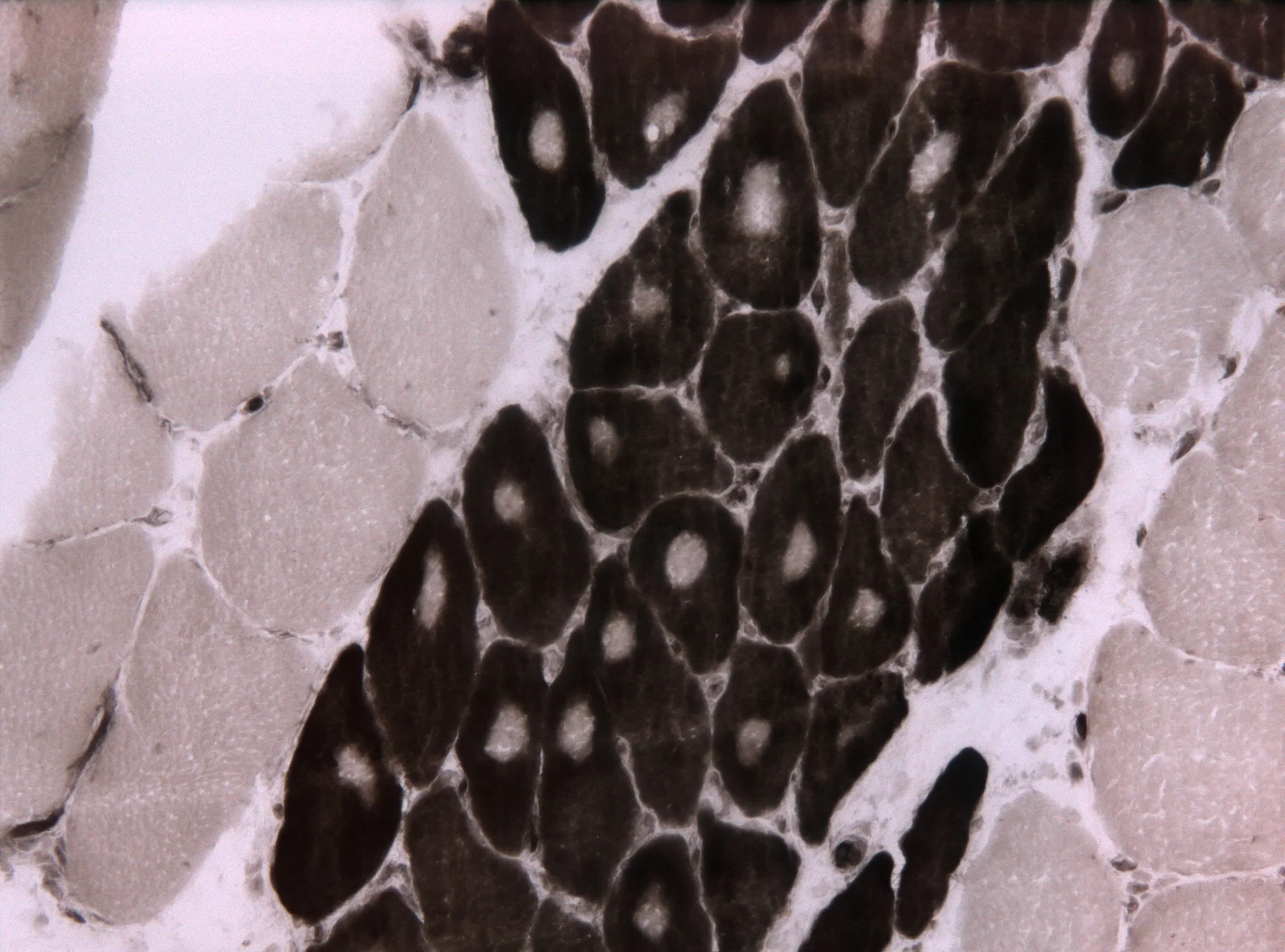 조직검사학 · ATPase stain (pH=4) displaying fiber type grouping and targetoid fibers indicative of neurogenic atrophy.