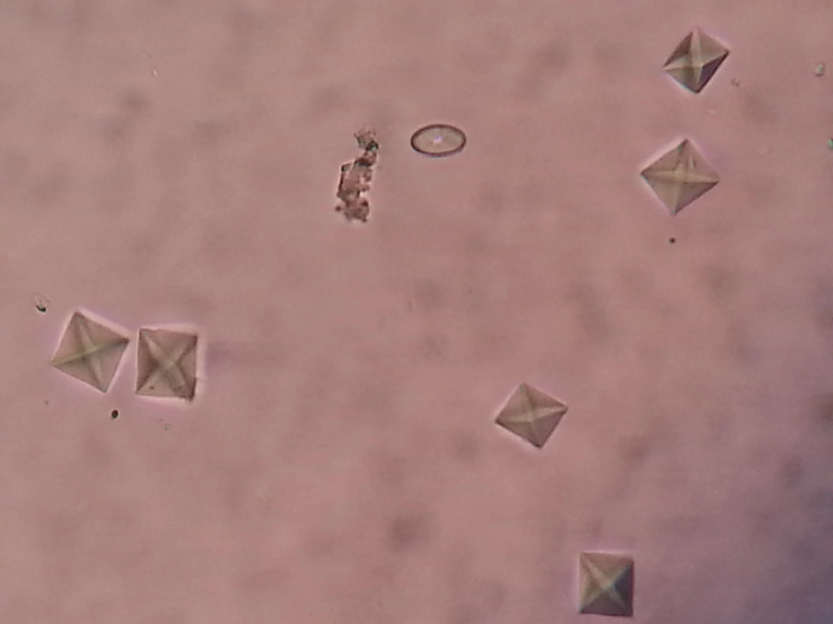 calcium oxalate crystals urine microscopy envelope · Composition: Calcium oxalate crystals are made up of calcium and oxalate ions. They can come in two primary forms: calcium oxalate monohydrate (COM