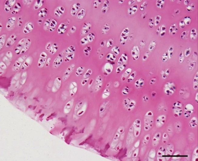 조직학 · Histology of deep zone of articular cartilage, consisting of fibers aligned perpendicularly to the bone interface to absorb compressive loads.