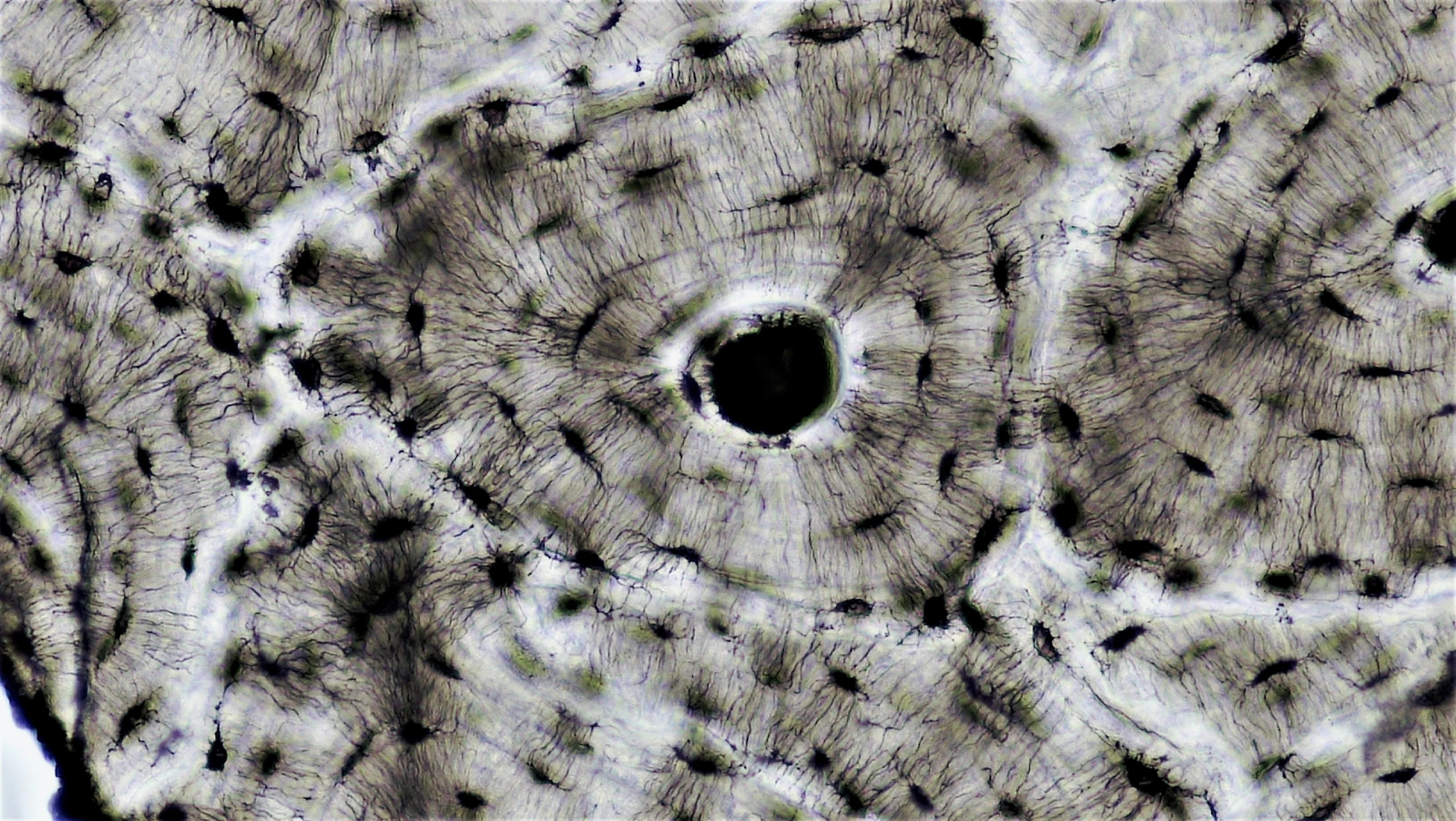 조직학 · cross section: ground human bone magnification: 200x