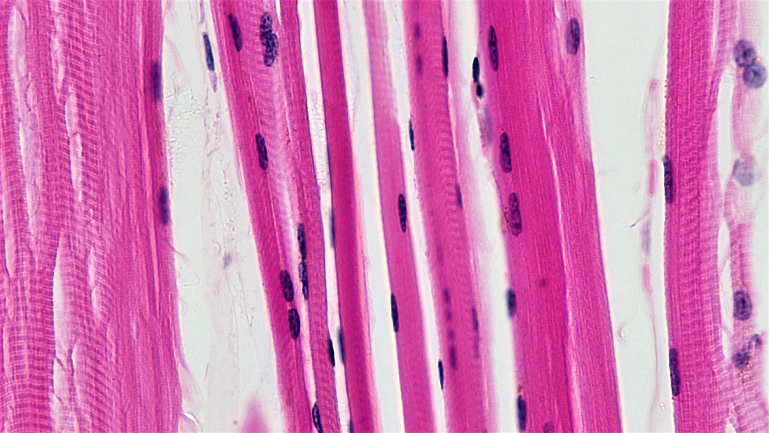 조직학 · Cross section of skeletal muscle fibers at 200x magnification
