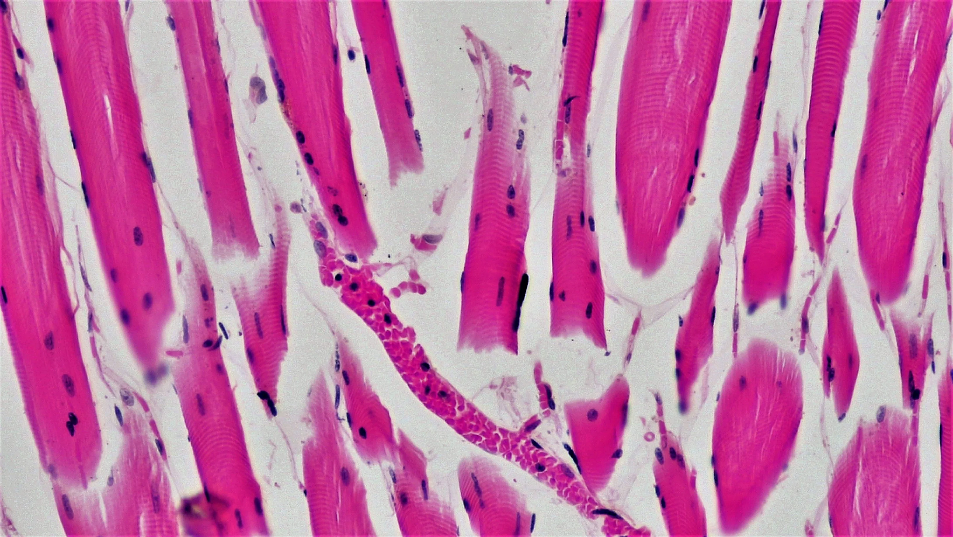 조직학 · Cross section: teased skeletal muscle magnification: 100x