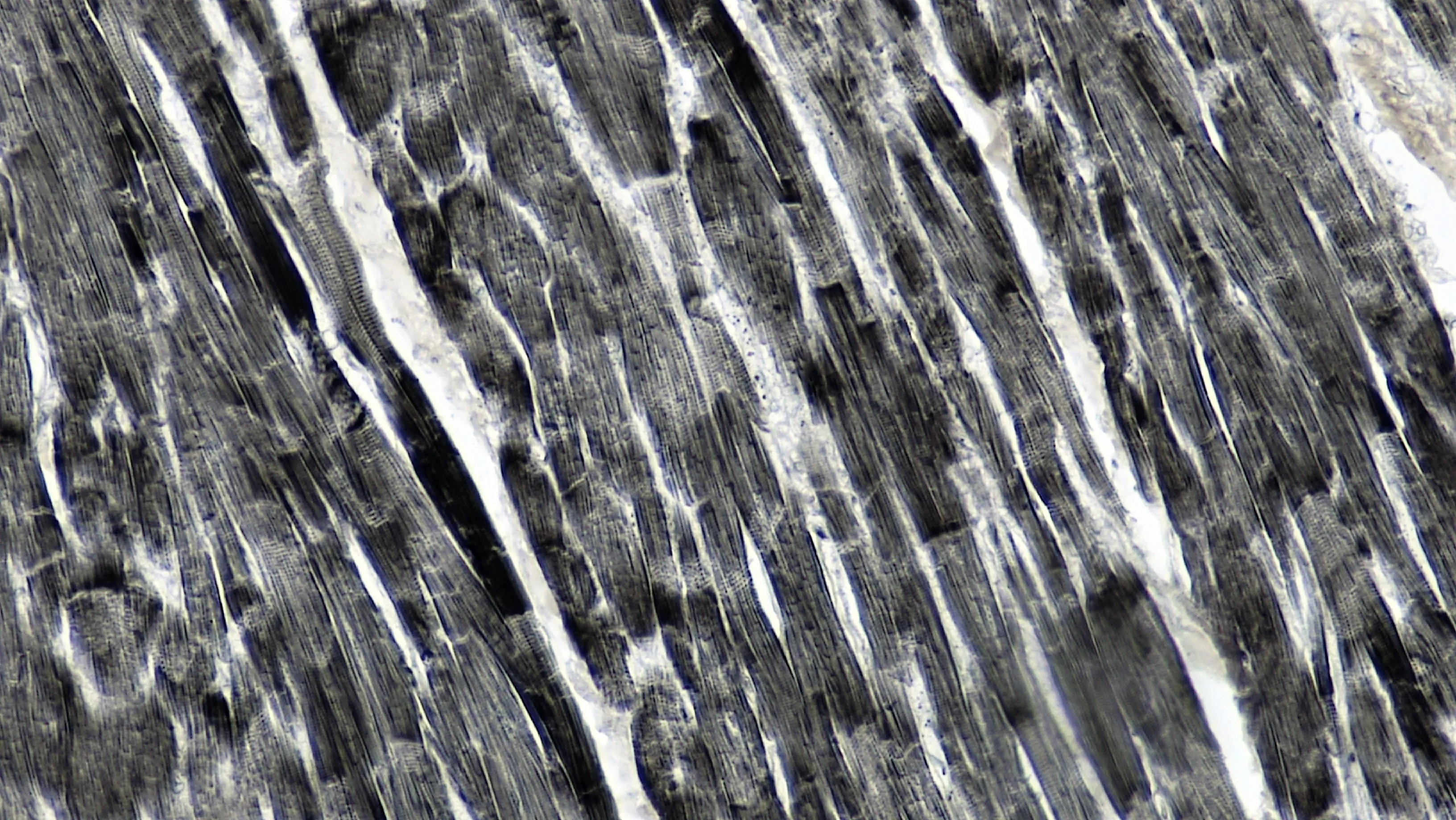 조직학 · long section: cardiac muscle magnification: 200x