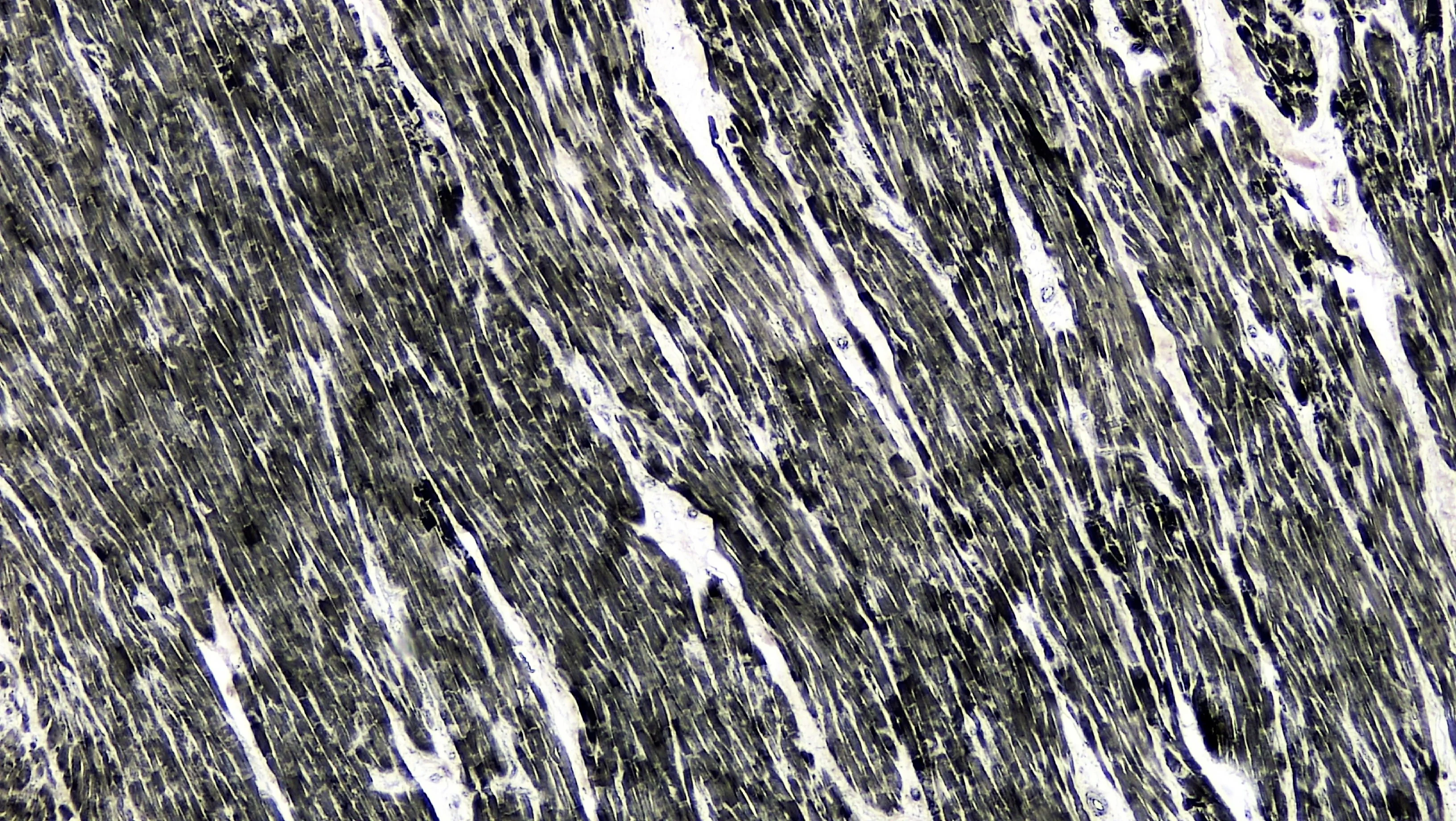 조직학 · long section: cardiac muscle magnification: 40x
