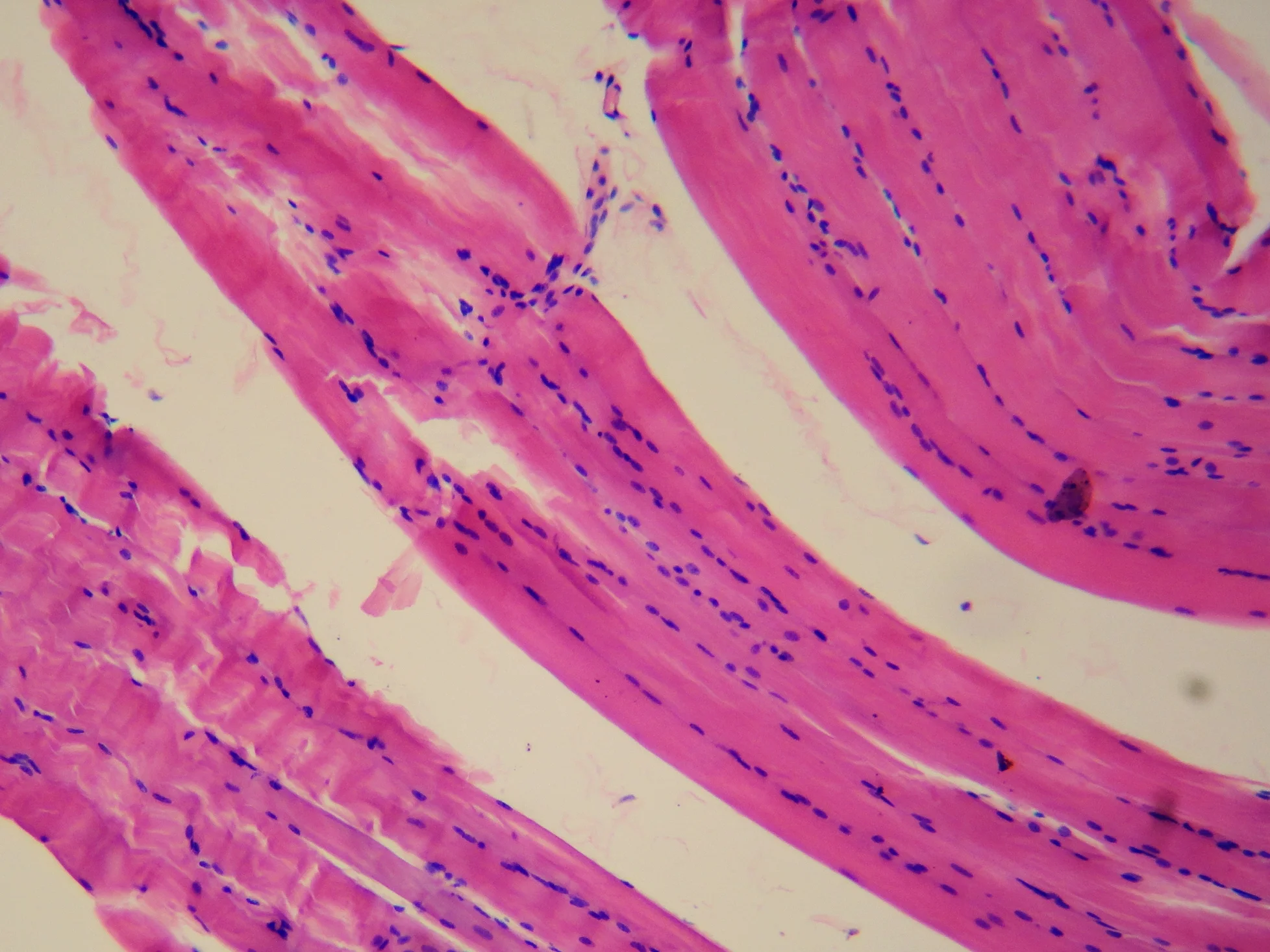 조직학 · Histología del músculo liso.