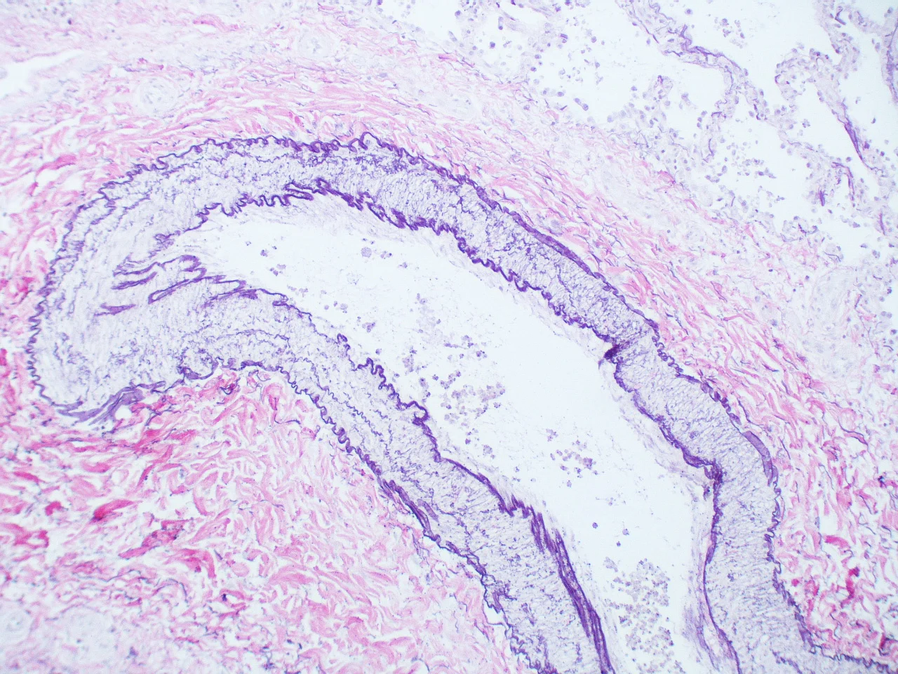 조직학 · Normal muscular pulmonary artery. Elastic tissue stain. Note the internal and external elastic laminaey; this is unique to muscular pulmonary arteries. The external elastic lamina is not present