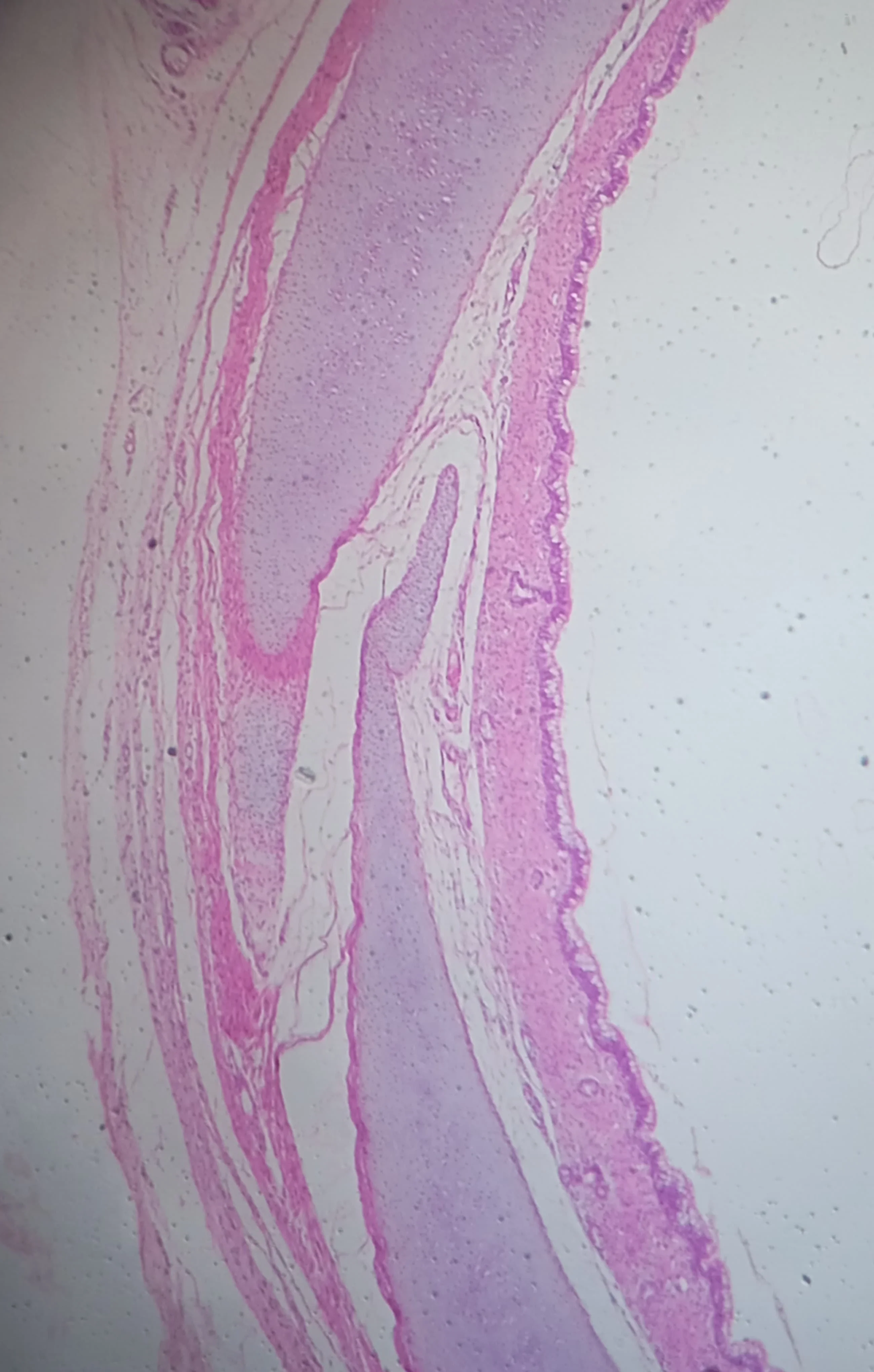 조직학 · Artéria elástica vista em corte histológico, microscopia óptica, coloração HE, tecido conjuntivo elástico pode ser visto