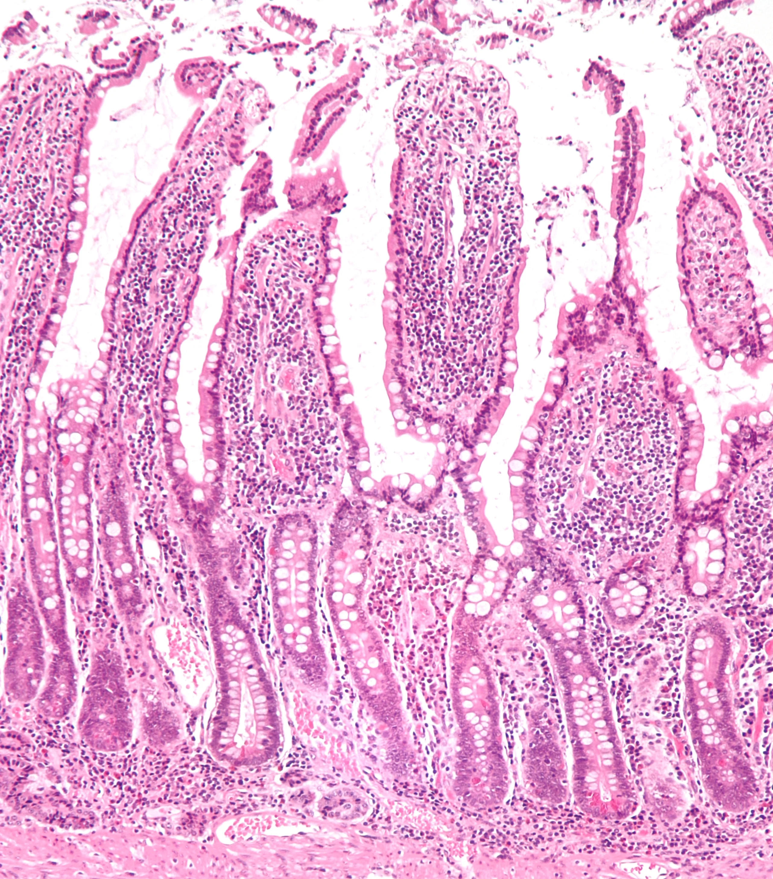 조직학 · Low magnification micrograph of small intestinal mucosa . H&E stain . See also Image:Small intestine neuroendocrine tumour low mag.jpg