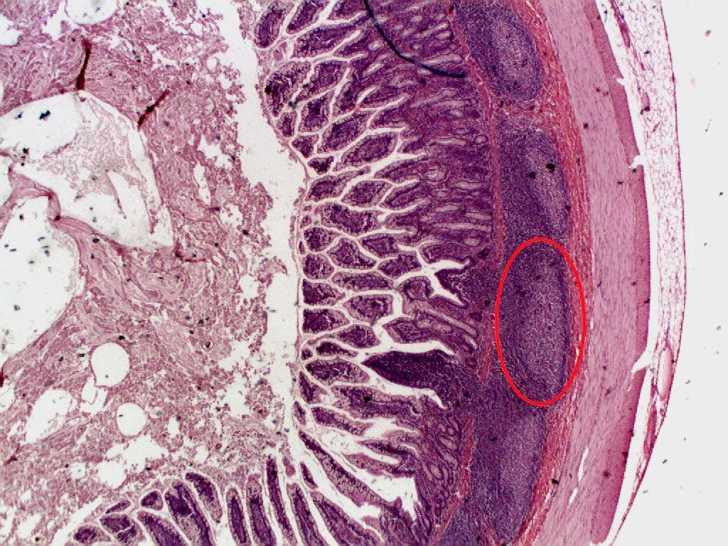 조직학 · A picture of Peyer's Patches, which are organized lymphoid nodules commonly found in the small intestines. This histology section was taken from the ileum (NOT jejunum), the final section of the