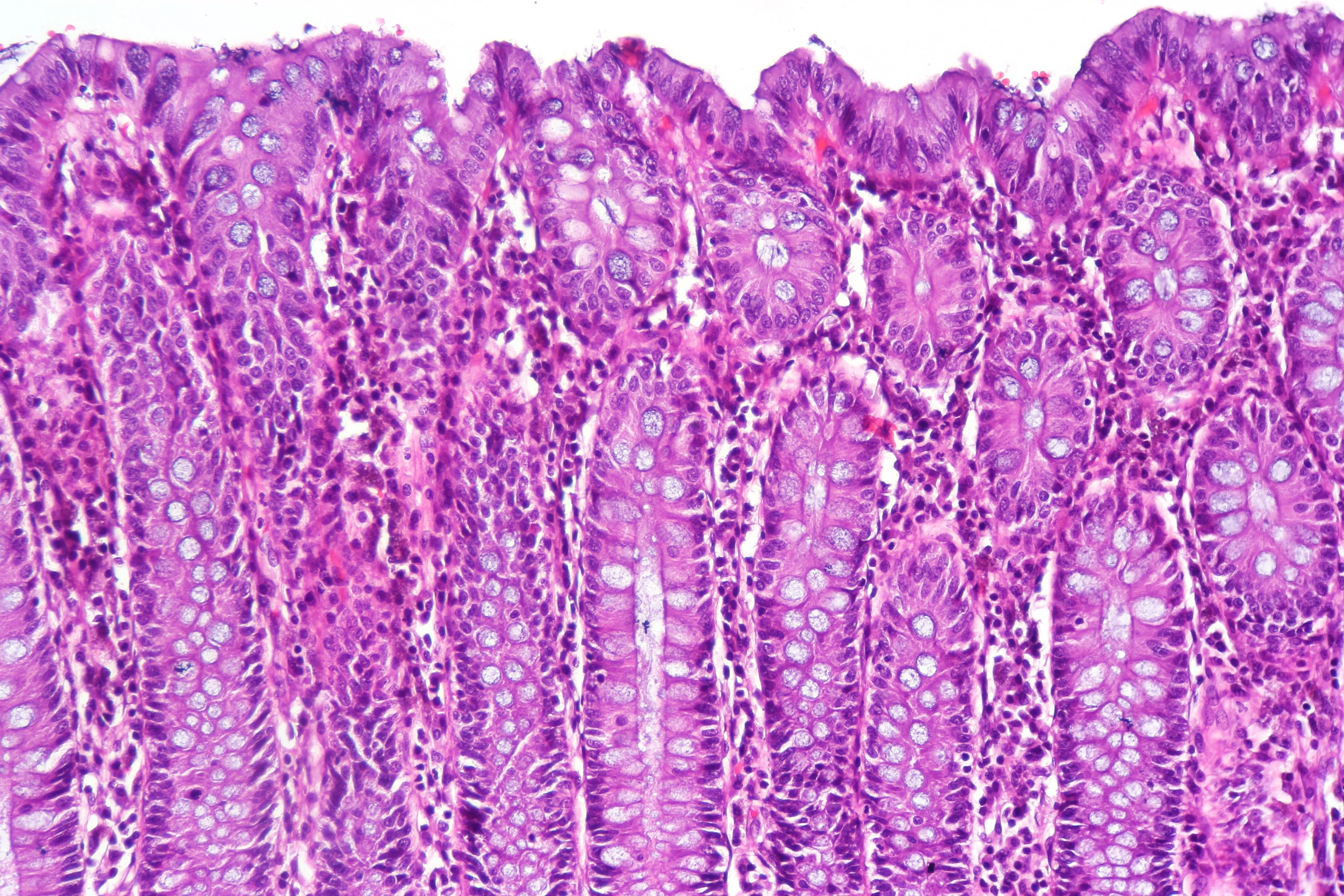 조직학 · Normal histology of the colon. H&E Stain.