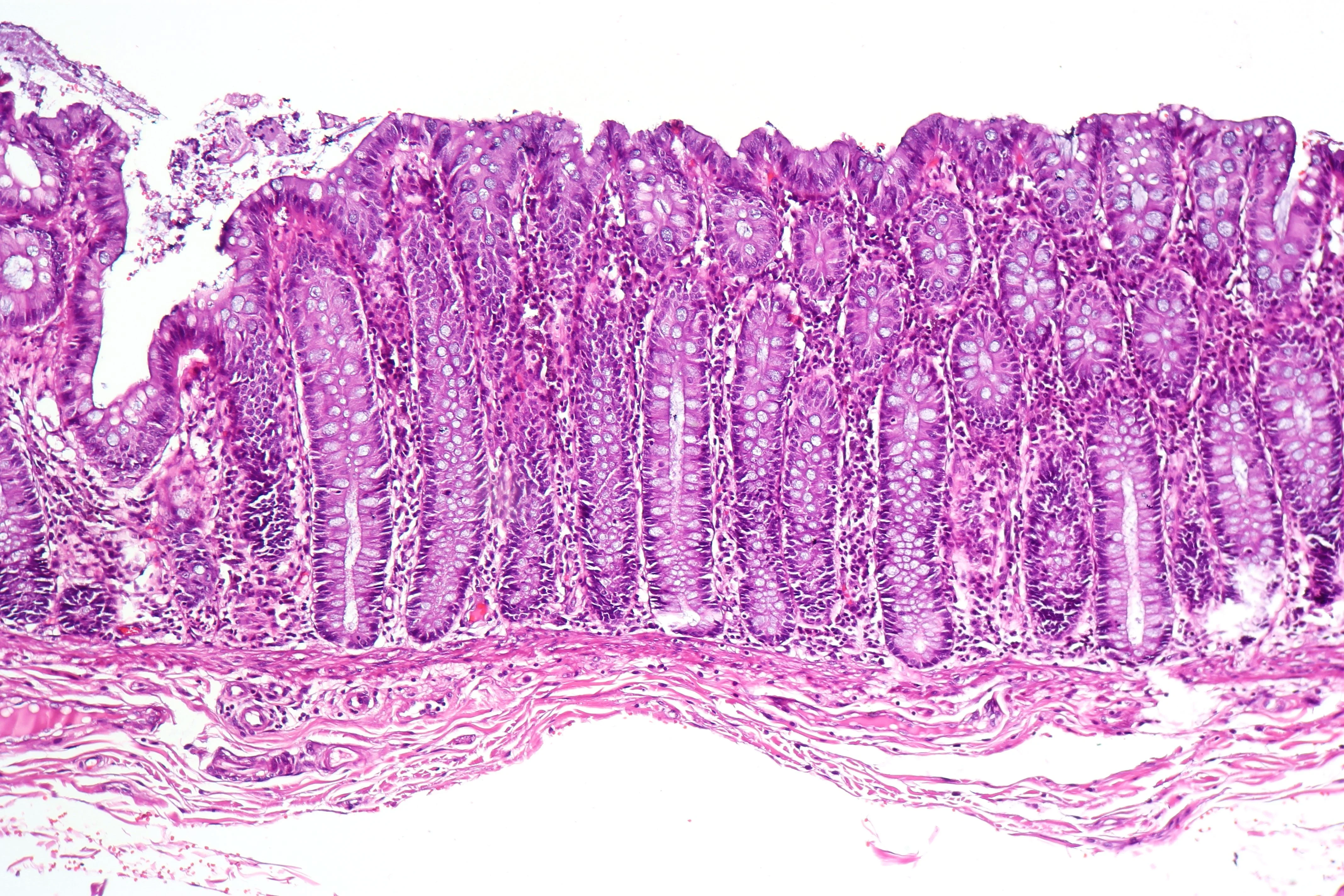 조직학 · Normal histology of the colon. H&E Stain.