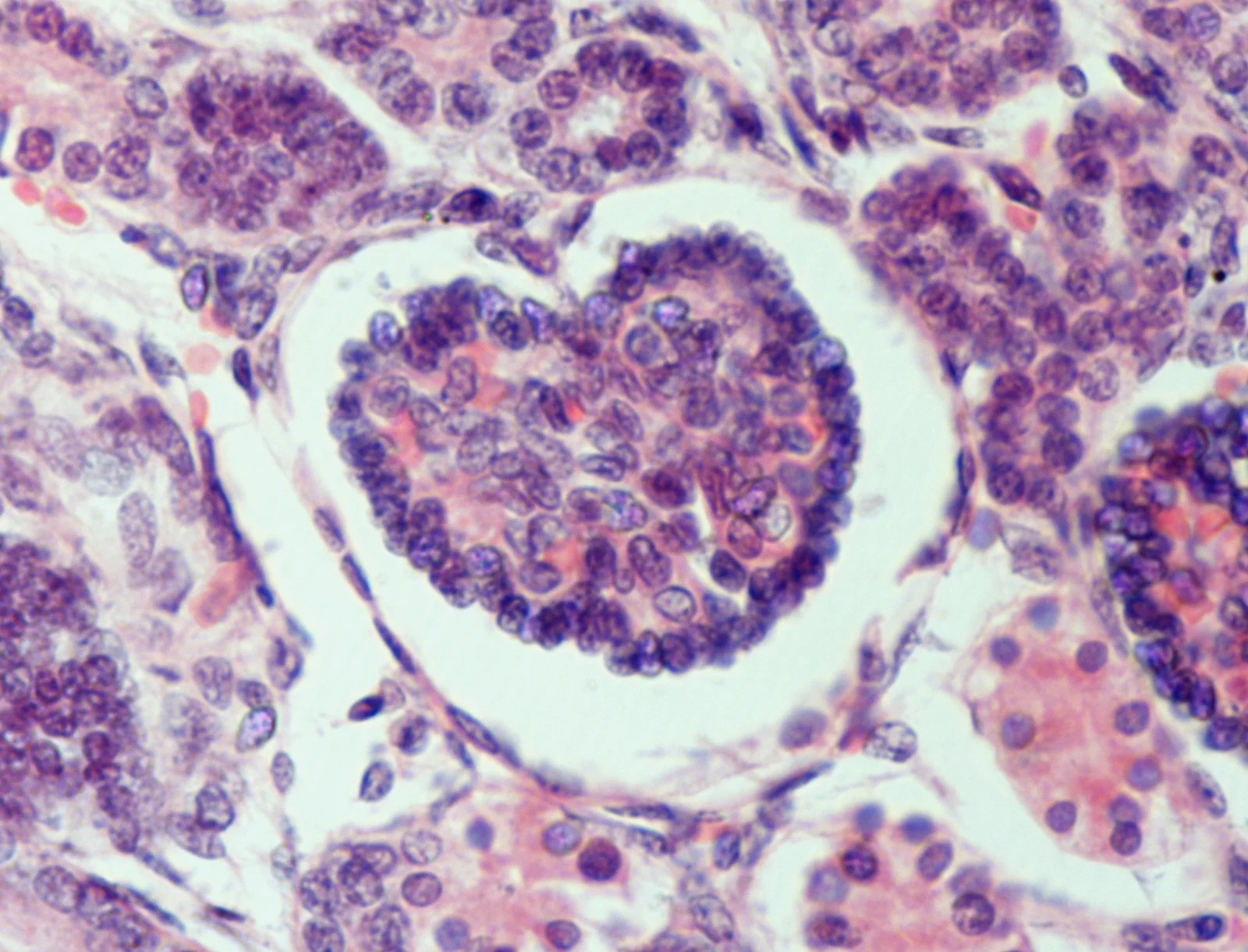 조직학 · "Lovely heart": Histological section of human renal corpuscle , H&E staining.