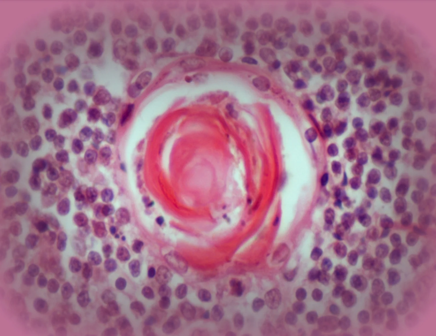 조직학 · "A rose for you": Human thymus gland histological section, Hassall's corpuscle, H&E staining.