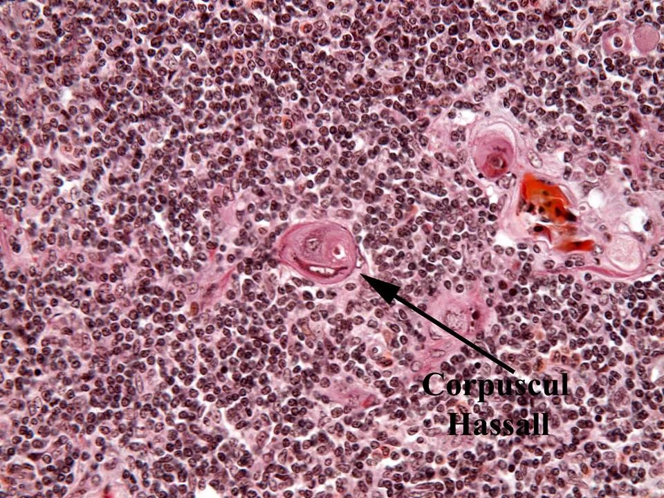 조직학 · Hassall bodie from lamb thymus, Goldner's trichrome stain