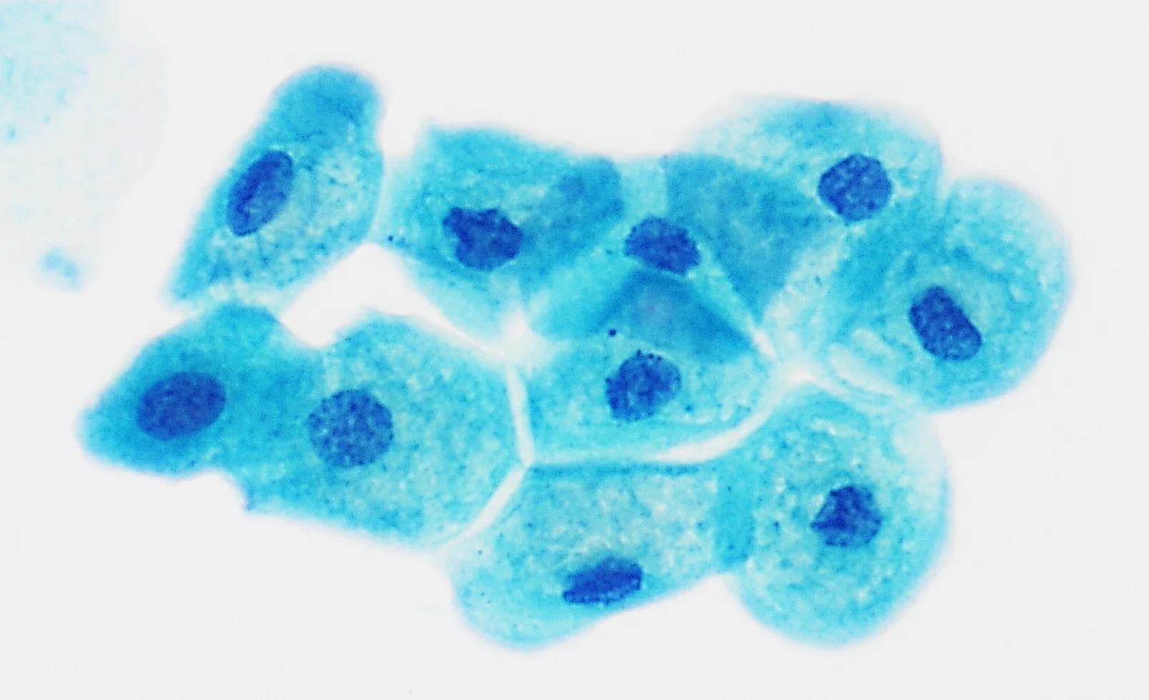 진단세포학 · Cytology of normal urothelial intermediate cells, Pap stain