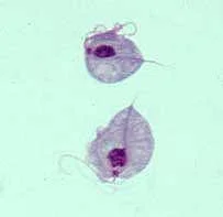 진단세포학 · Two trophozoites of Trichomonas vaginalis obtained from in vitro culture. Smear was stained with Giemsa.