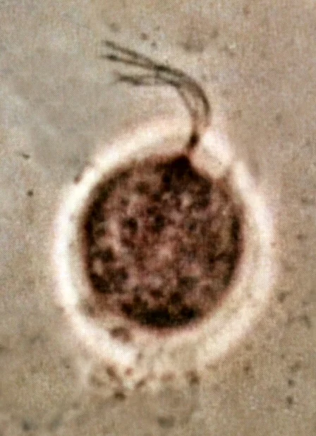 진단세포학 · Trichomonas vaginalis photographed by phase contrast microscopy