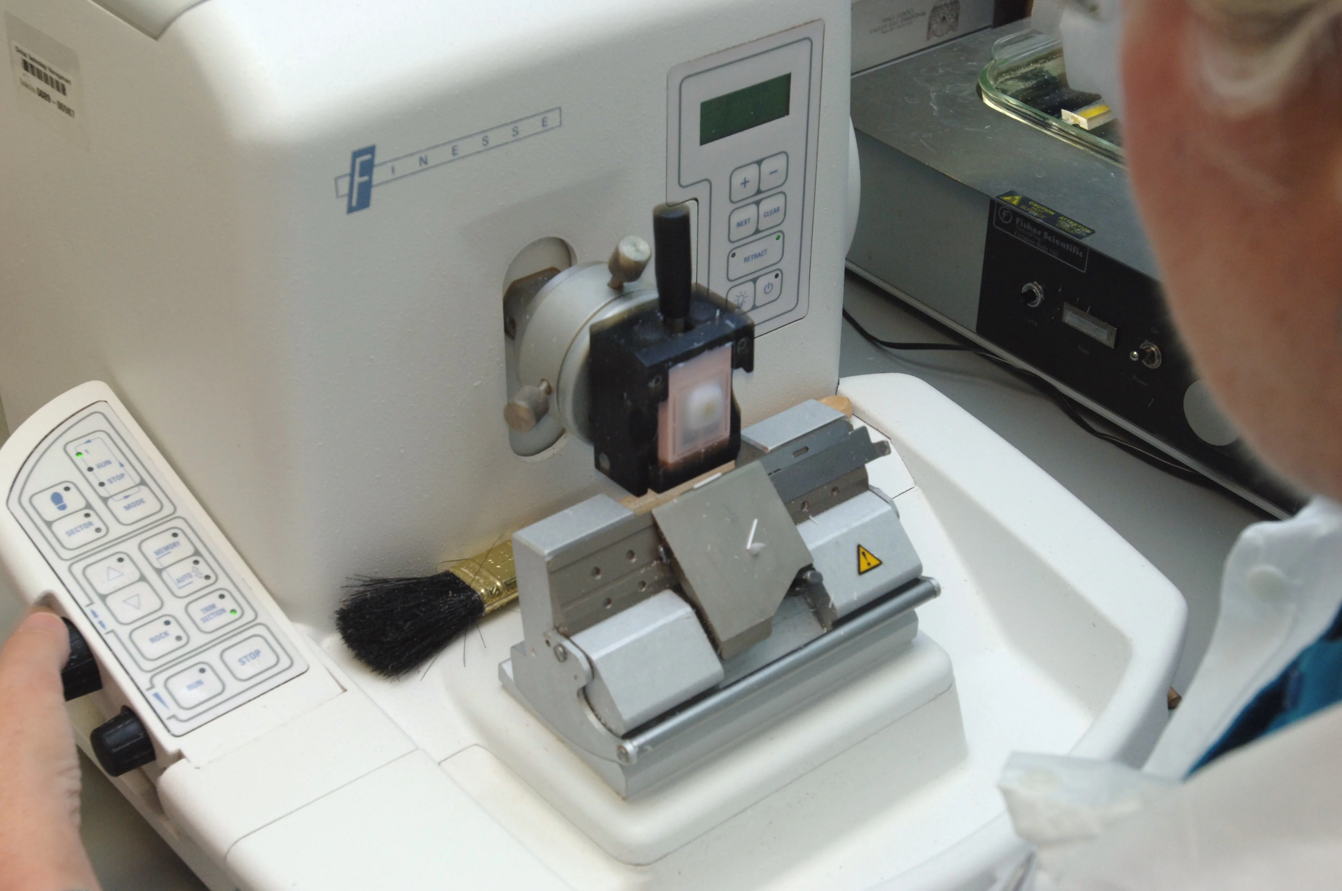 조직검사학 · The solid paraffin block is mounted on the tissue holder of a microtome. The holder is passed up and down in front of a very sharp blade, advancing the tissue forward very slightly with each s