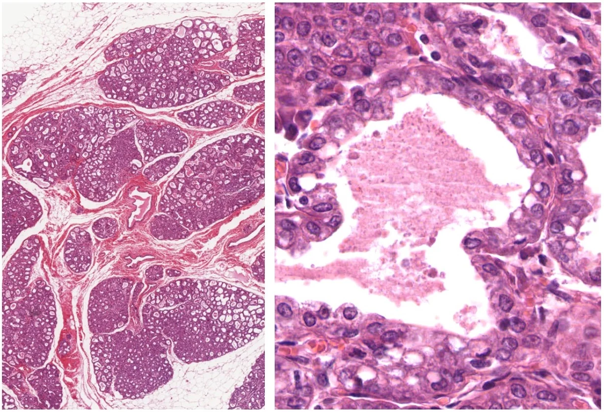 조직검사학 · Histology of lactating breast, H&E stain