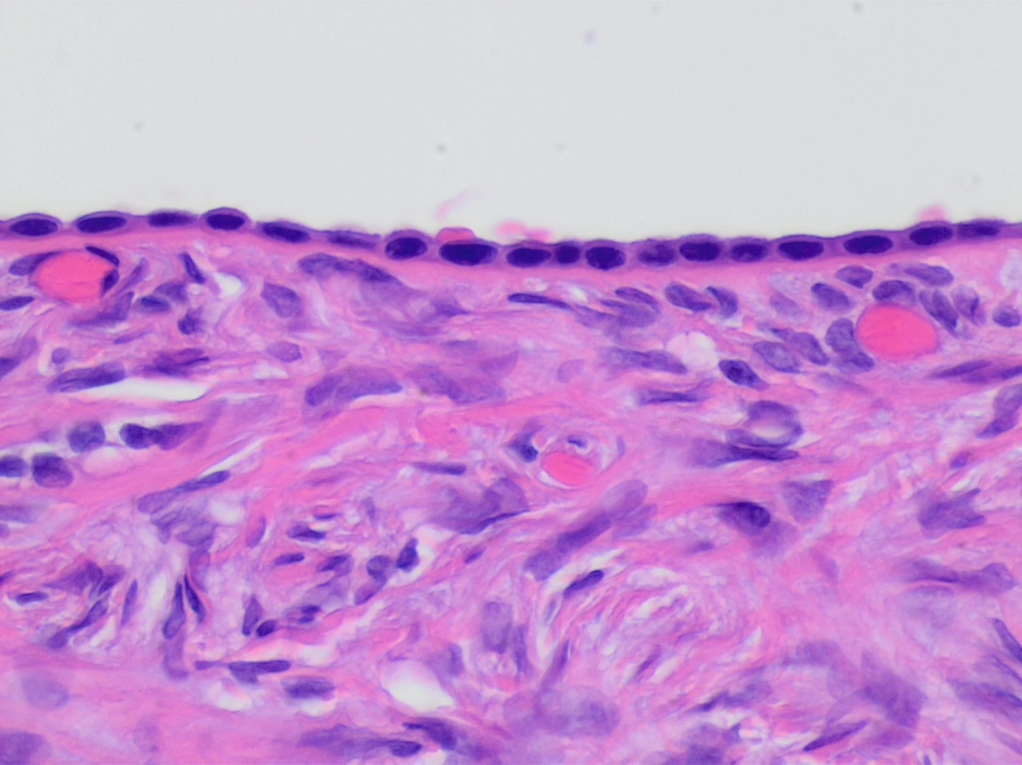 조직검사학 · Histology of ovarian surface epithelium. H&E stain. The epithelium is the chain-like covering with round dark blue nuclei at top.