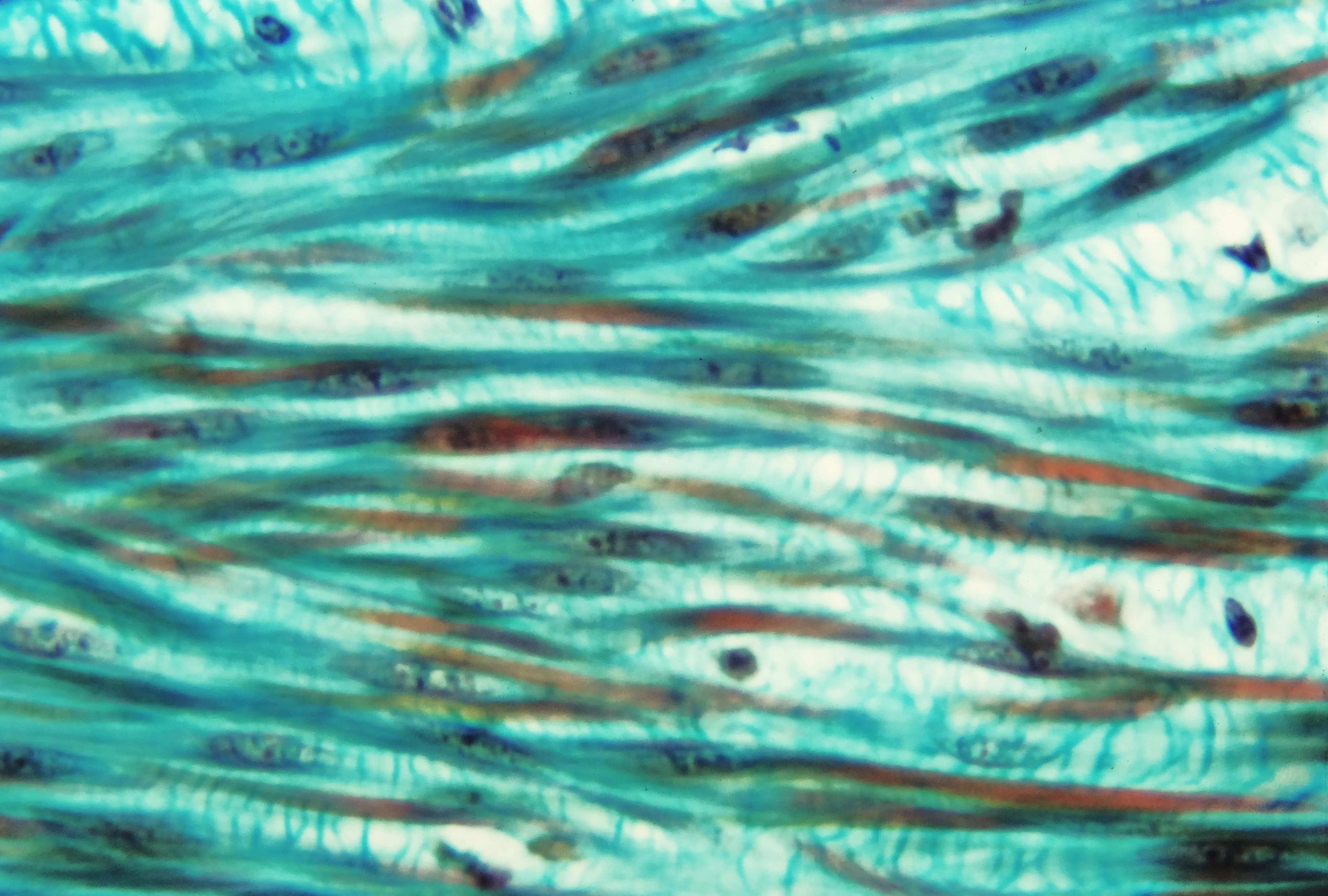조직검사학 · Light micrograph of longitudinally sectioned smooth muscle tissue (Masson/Goldner-staining