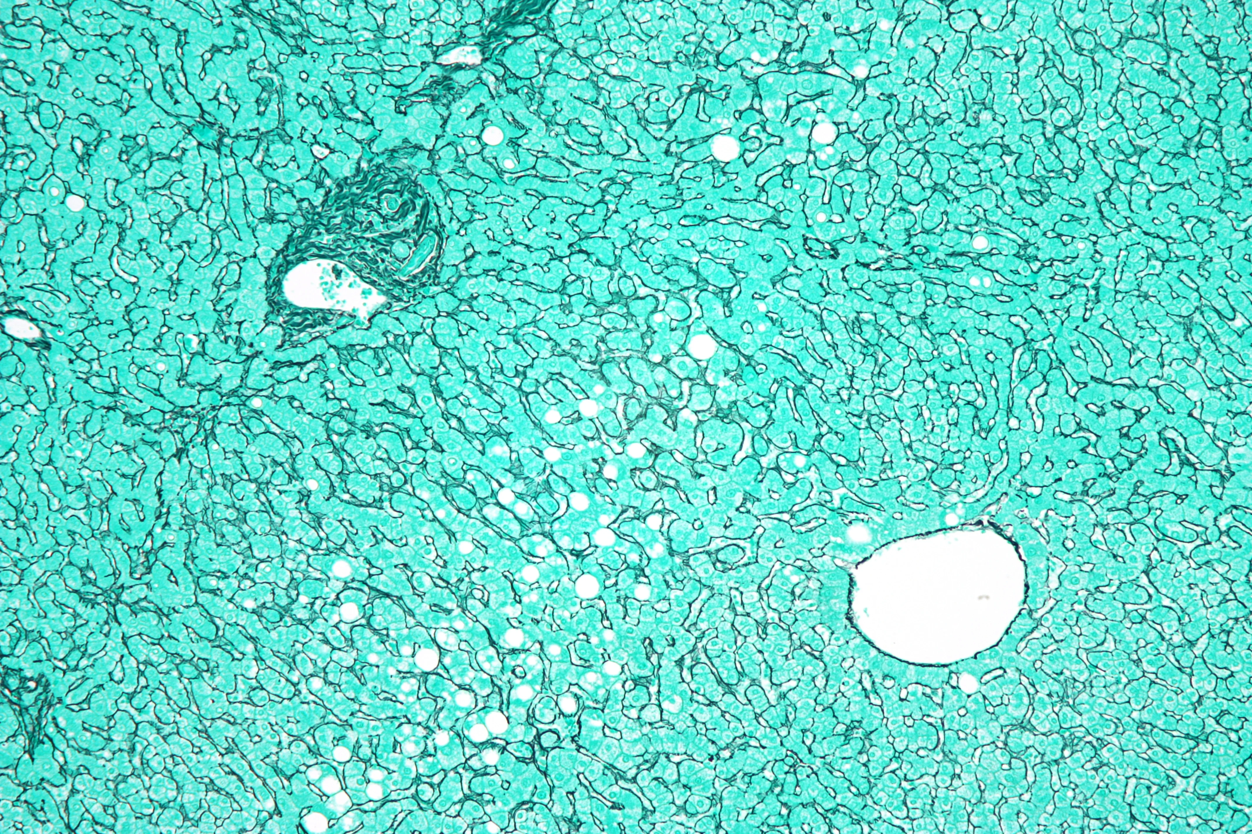 조직검사학 · Micrograph of the liver showing a portal tract and a nearby hepatic venule . Reticulin stain . The normal "hepatocyte plate" -- the strands of hepatocytes that characterise the morphology of t