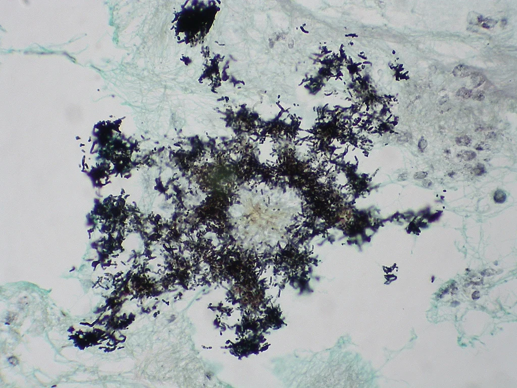 조직검사학 · Geotrichosis A colony of Geotrichum candidum stained with GMS. This fungus reproduces by segmentation of hyphae into arthrospores with straight or rounded ends.
