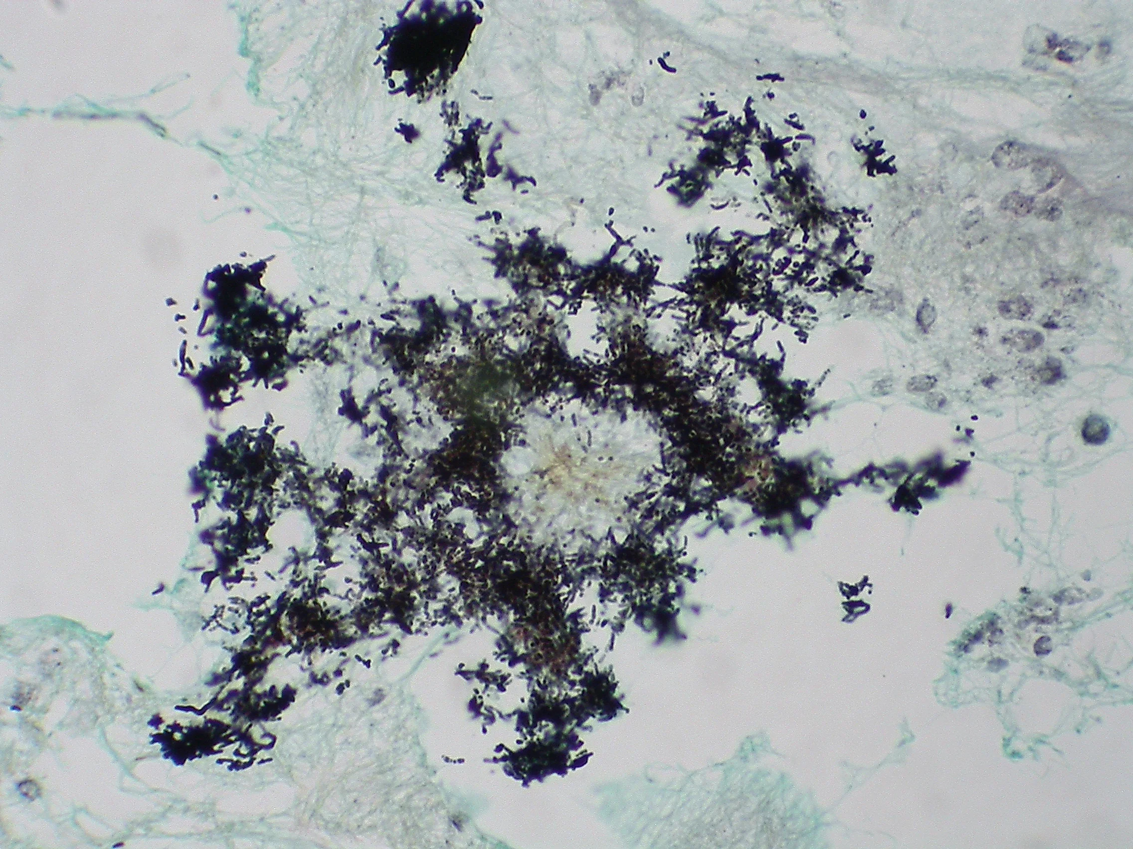 조직검사학 · A colony of Geotrichum candidum stained with GMS. This fungus reproduces by segmentation of hyphae into arthrospores with straight or rounded ends.