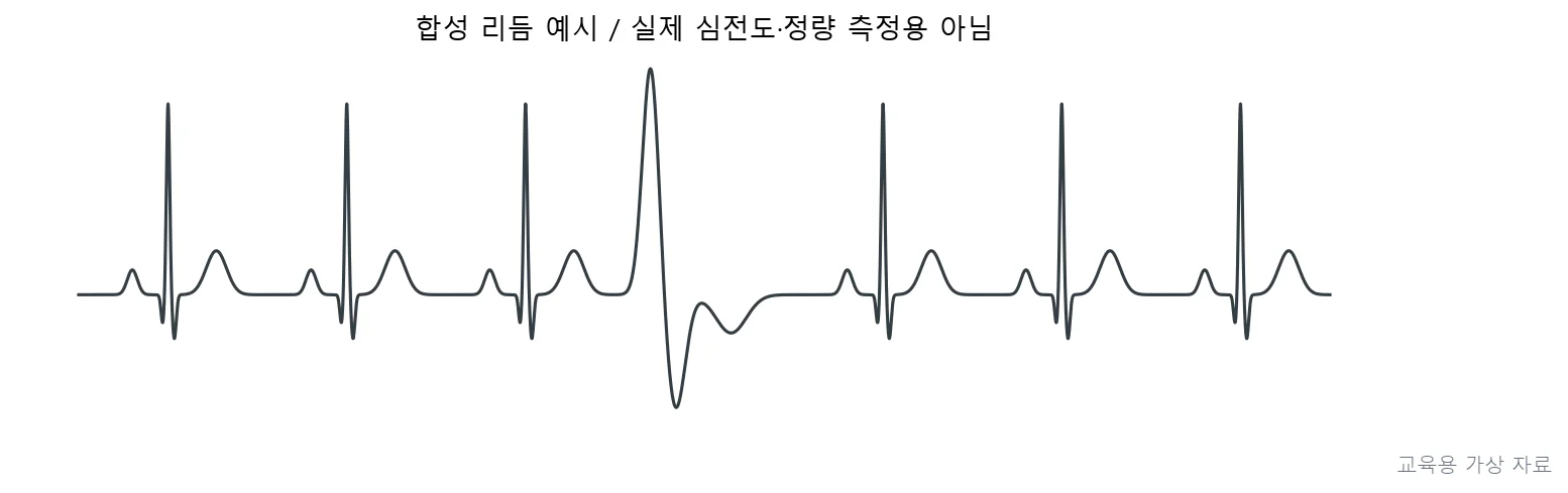 실기시험 · PT4P-R3-Q044;운동 중 단발성 PVC가 관찰되지만 증상이 없고 혈압이 안정적. (교육용 도판)