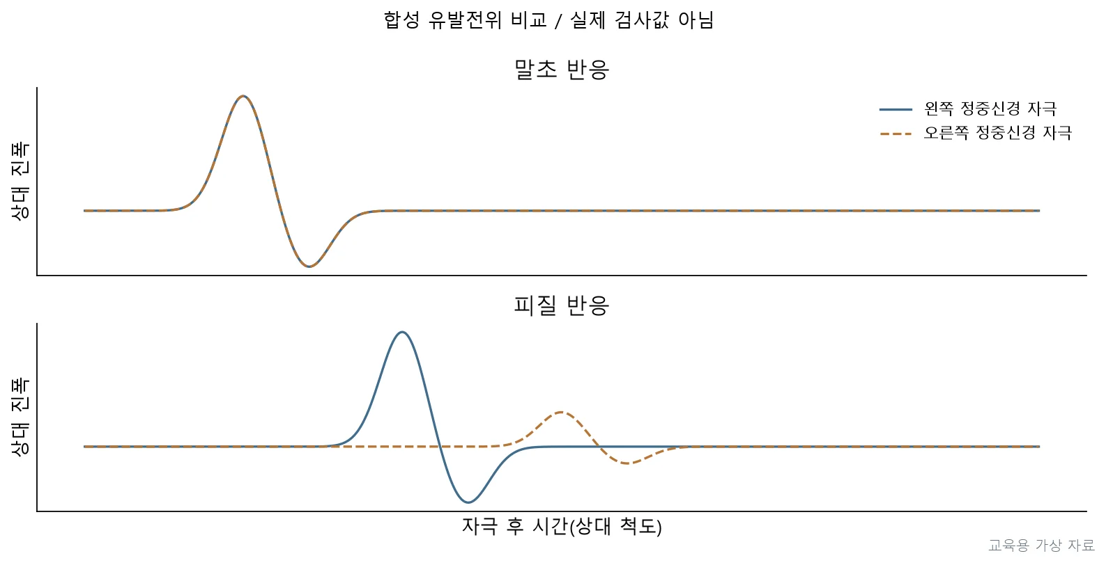 실기시험 · PT5P-R3-Q028;우측 정중신경 자극 시 피질 전위 진폭이 좌측에 비해 현저히 낮고 잠복기가 길게 나타남을 확인한다. (교육용 도판)