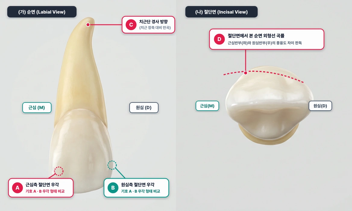 상악 우측 중절치(#11)의 순면 및 절단면 모식도 (치아의 3대 상징)