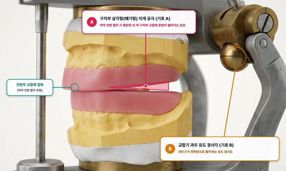 총의치 하악 전방 운동 시 구치부 이개 공극(크리스텐슨 현상) 및 시상과로경사각 보상만곡