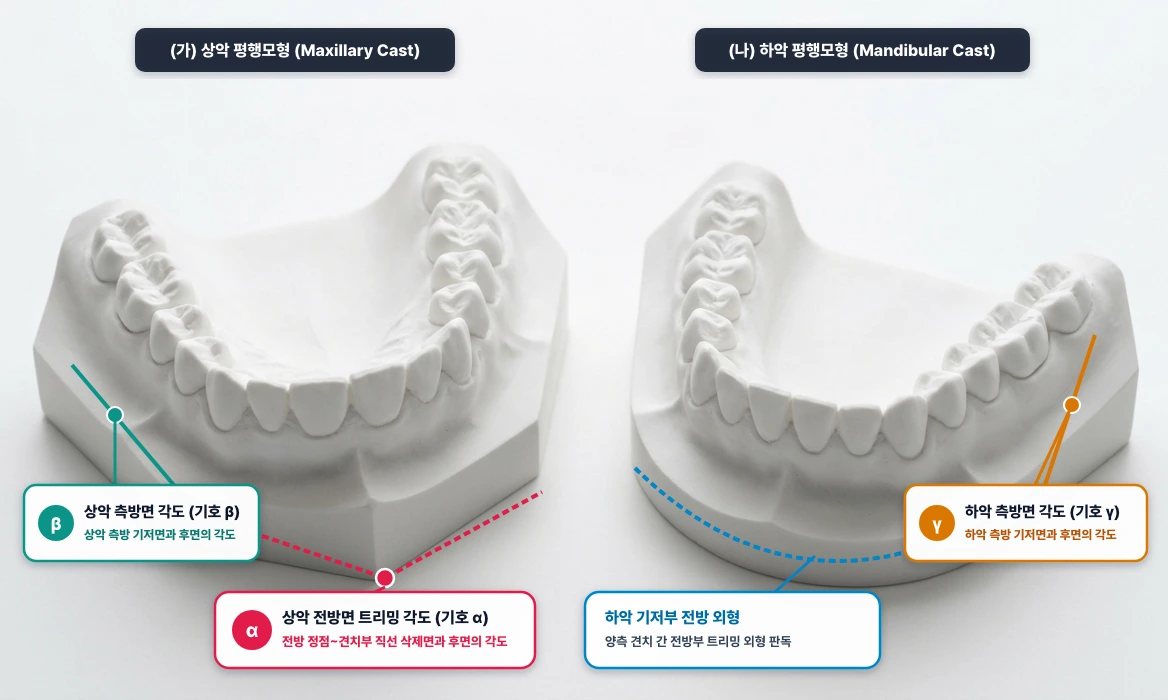 치과교정기공학 평행모형(Parallel Study Cast) 상·하악 기저부 트리밍 각도(α, β, γ)
