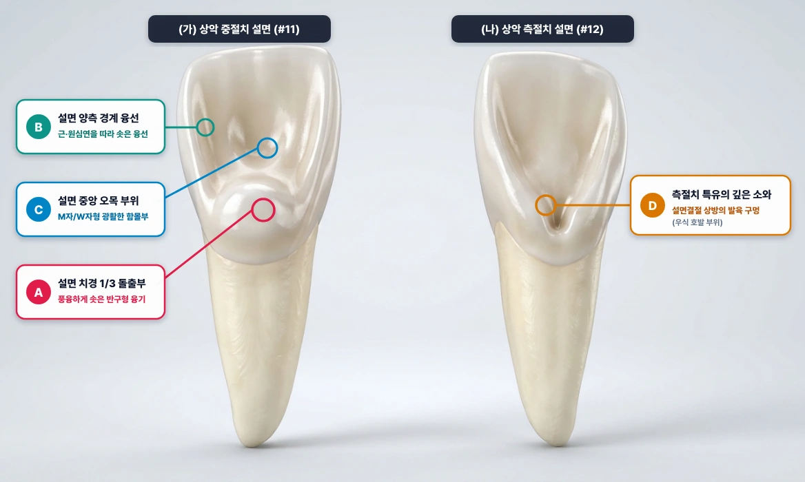 상악 중절치(#11)와 상악 측절치(#12)의 설면 해부 구조 (설면결절·변연융선·설면와·맹공)