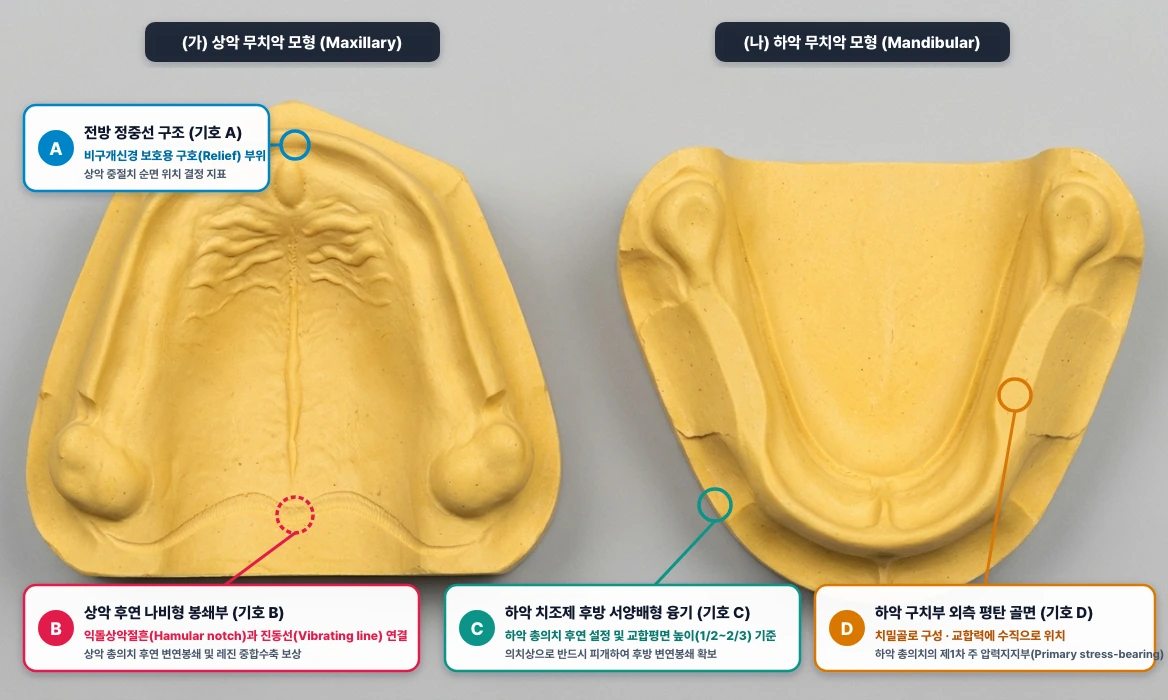 무치악 상·하악 모형의 주요 해부학적 구조 (절치유두·후구개폐쇄부·구후융기·협붕)