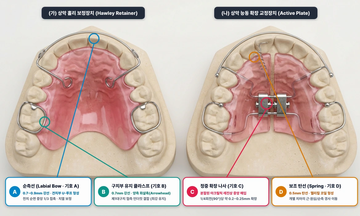 가철식 교정·보정장치 구조 비교: (가) 홀리 보정장치(Hawley) vs (나) 능동 확장상(Active Plate)