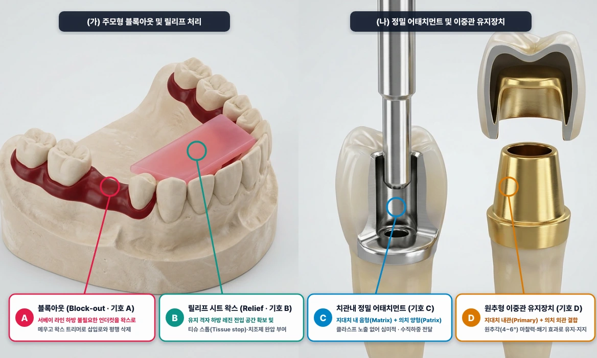 국소의치 주모형 블록아웃(A)·릴리프(B) 처리(가) 및 치관내 정밀 어태치먼트(C)·이중관(D) 비교(나)