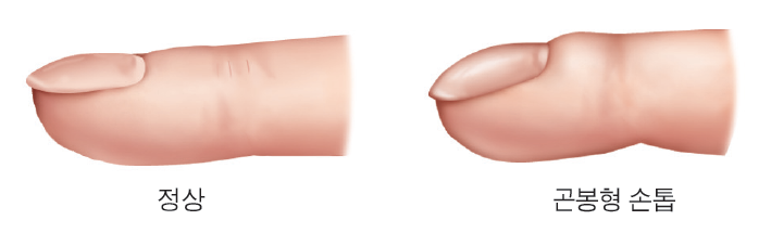 debf180358059ce7232c414937363782_1710979999_1213.png