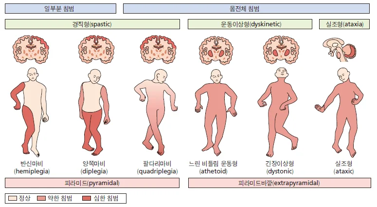 d218a3b4be77bcd26e7ad1844ee7e515_1773729640_5003.webp