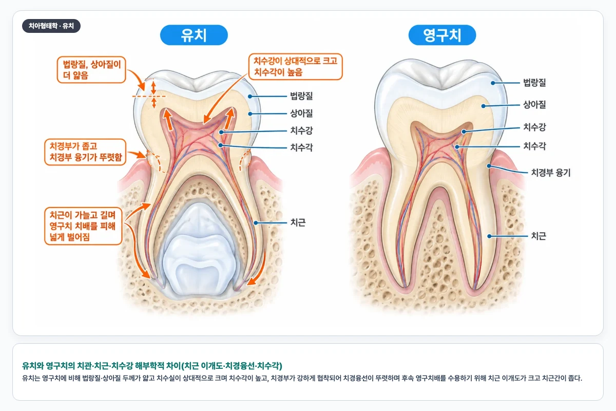 유치와 영구치의 치관·치근·치수강 해부학적 차이(치근 이개도·치경융선·치수각)
