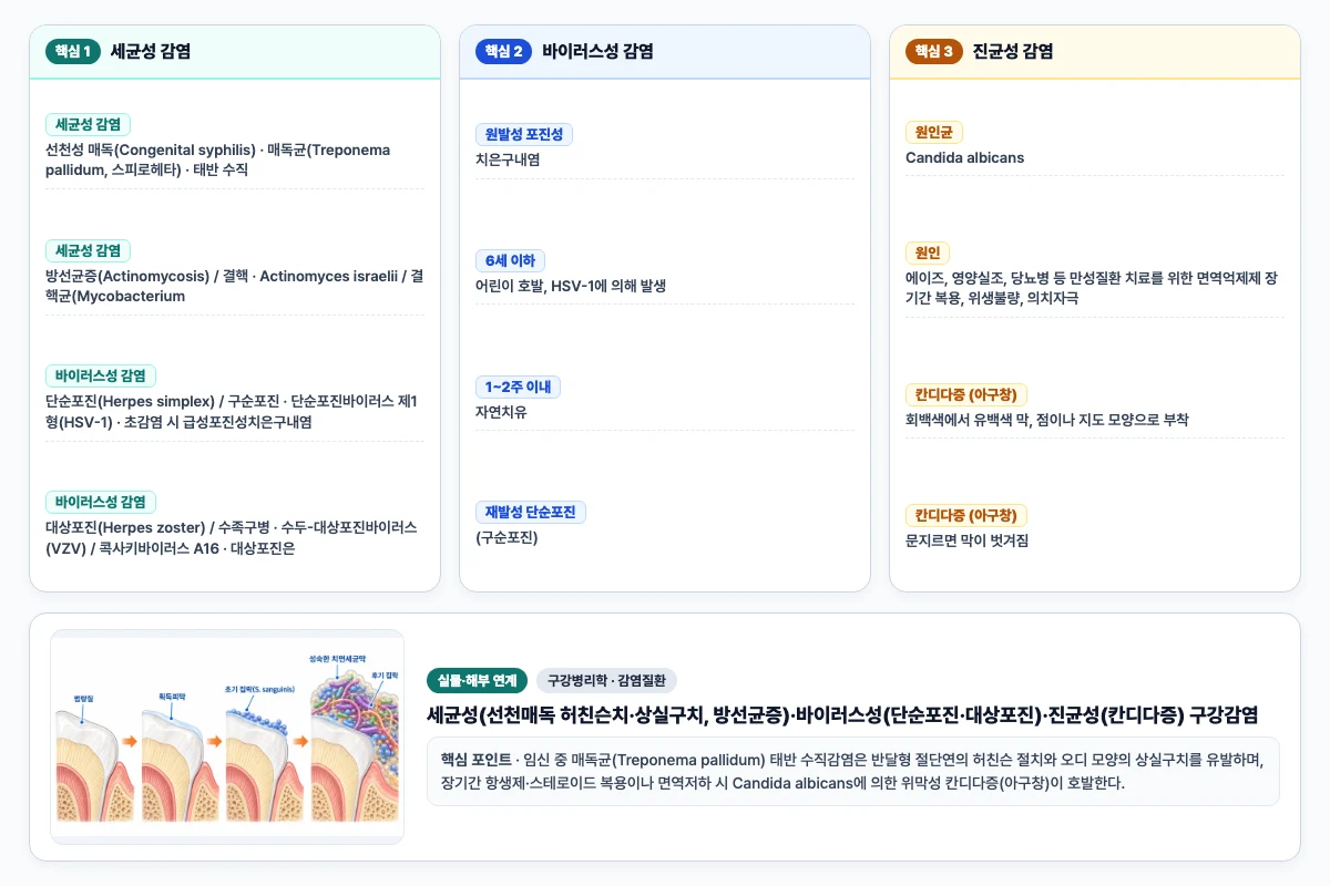 구강병리학 감염질환 핵심 비교 및 단계별 기전 도해
