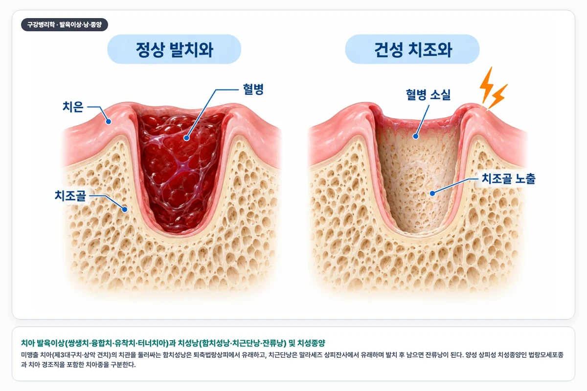 치아 발육이상(쌍생치·융합치·유착치·터너치아)과 치성낭(함치성낭·치근단낭·잔류낭) 및 치성종양